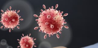 38 Legionnaires Cases and Two Deaths in Westchester