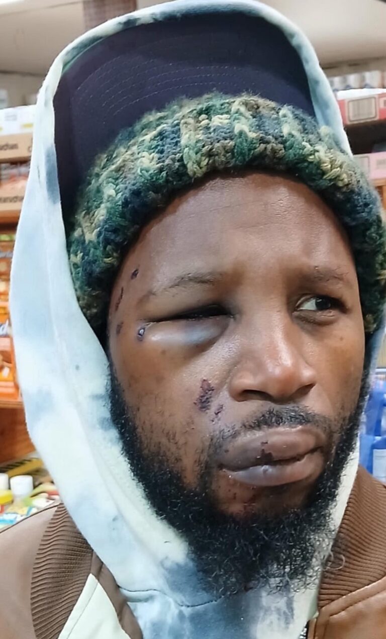Peekskill Police Officer Caught on Video Tasing and Kicking Homeless Man