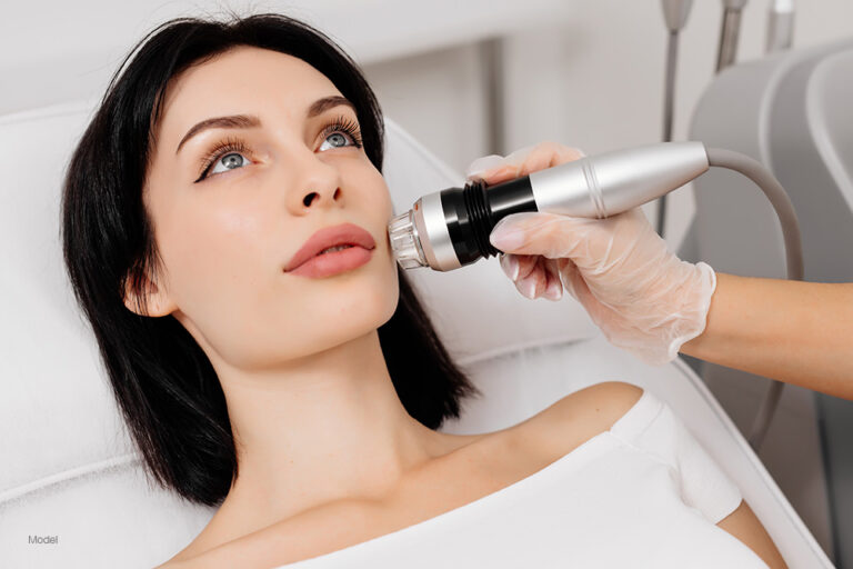How Microneedling Treats Scars and Fine Lines Without Downtime